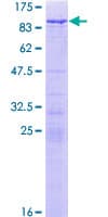 Human WHSC1 / NSD2 Protein (Recombinant GST)