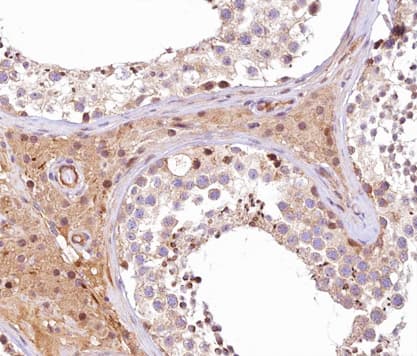 Polyclonal Rabbit anti-Human APG4B / ATG4B Antibody (IHC, IF, WB)