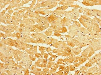 Polyclonal Rabbit anti-Human FBXO4 / FBX4 Antibody (IHC)