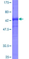 Human RPSA / Laminin Receptor Protein (Recombinant GST)