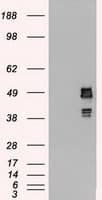 SSB / La Antibody (clone OTI2C8)