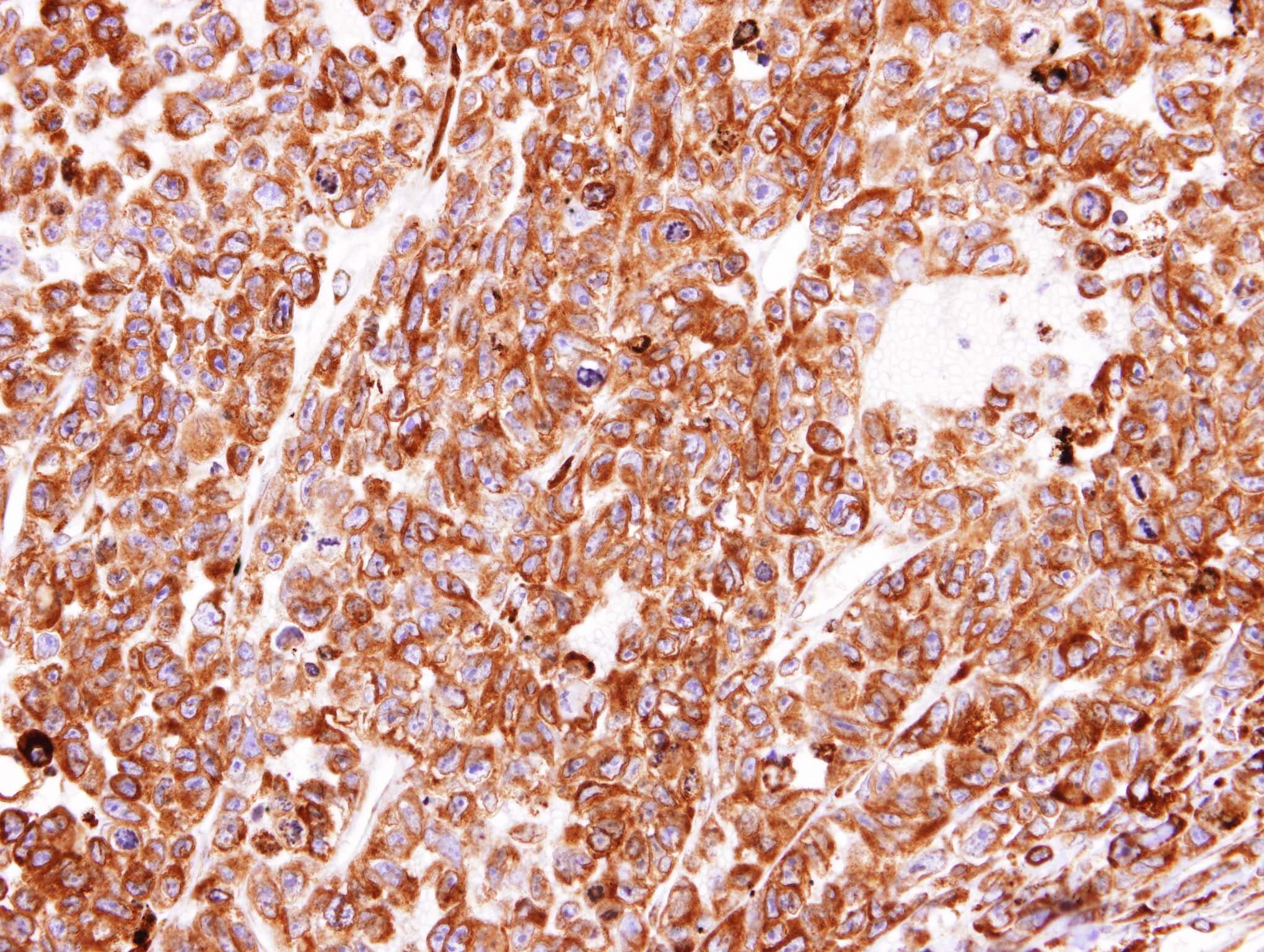 PDI / P4HB Antibody (aa23-227)