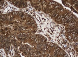 PAI-RBP1 / SERBP1 Antibody (clone OTI4G2)