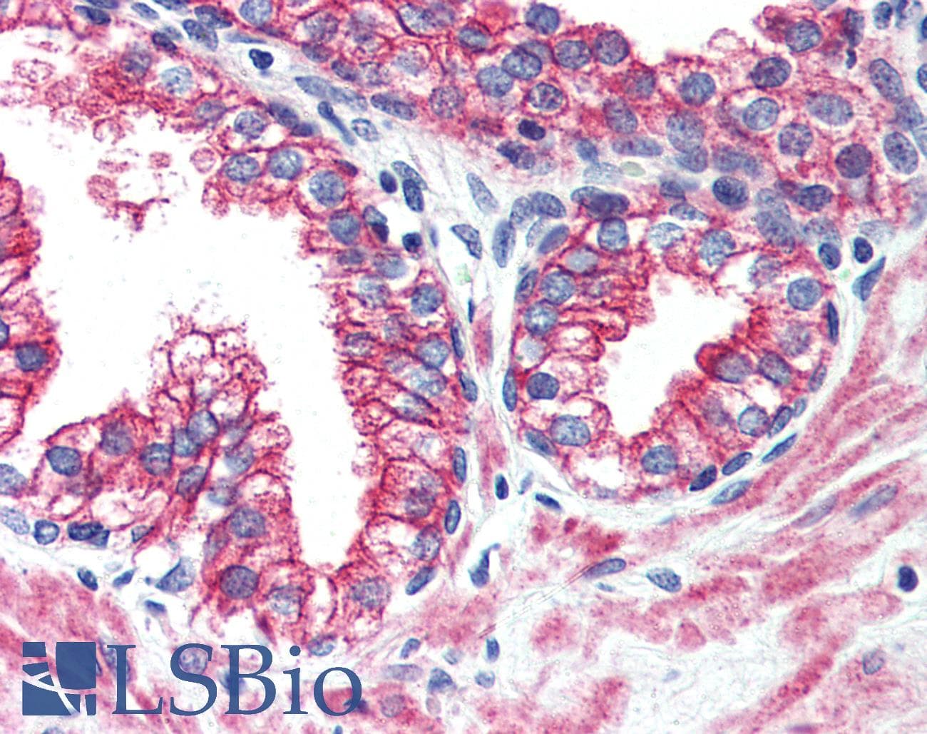 IHC-plus™ ERBB2 / HER2 Antibody (N-Terminus)