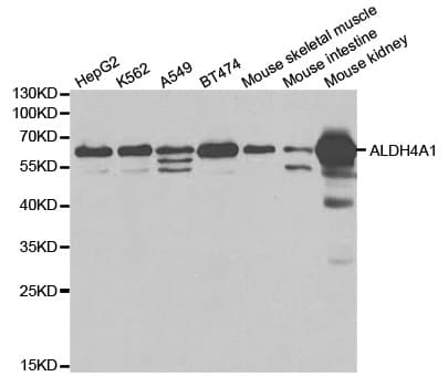 Polyclonal Rabbit anti-Human P5CDH / ALDH4A1 Antibody (IHC, IF, WB)
