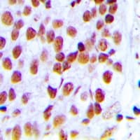 Polyclonal Rabbit anti-Human XRCC5 / Ku80 Antibody (C-Terminus, IHC, IF, WB)