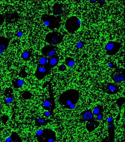 Polyclonal Rabbit anti-Human SYP / Synaptophysin Antibody (aa225-253, IHC, IF, WB)