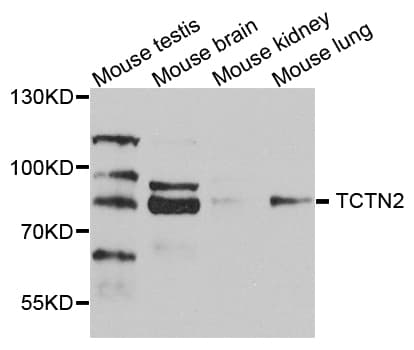 TCTN2 Antibody