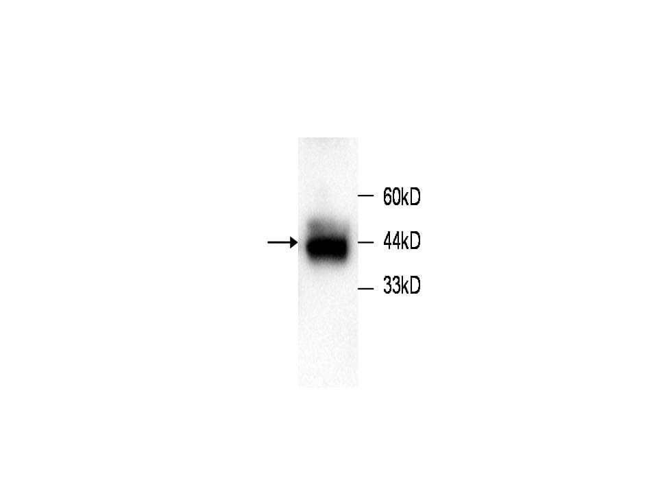 STMN1 / Stathmin / LAG Antibody (clone 13)