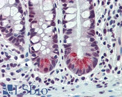 IHC-plus™ SRSF1 / SF2 Antibody (aa1-50)