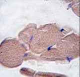MSTN / GDF8 / Myostatin Antibody (aa9-38)