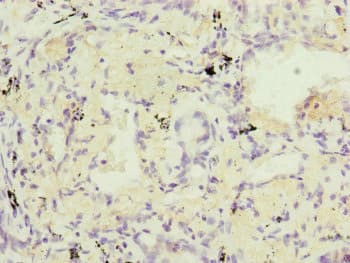 RARS2 / ARGRS Antibody