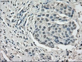 Monoclonal Mouse anti-Human CYPOR / POR Antibody (clone OTI3F10, IHC, IF, WB)