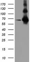 ZIM2 Antibody (clone OTI5E12)