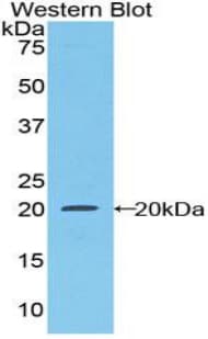CSF1R / CD115 / FMS Antibody (aa734-900, PE)
