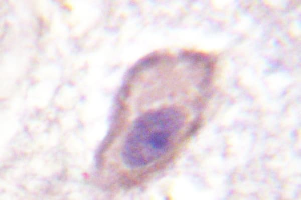 CD119 / IFNGR1 Antibody (Gly456)