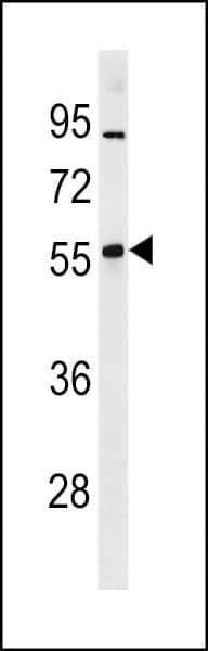 ZNF260 Antibody (aa89-115)