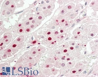 IHC-plus™ Polyclonal Rabbit anti-Human TBPL2 / TRF3 Antibody (aa81-130, IHC, WB)