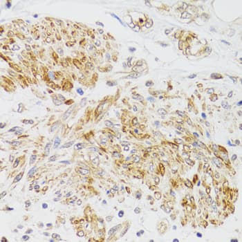 MYO5A / Myosin V Antibody