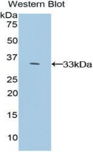 MAPK1 / ERK2 Antibody (aa104-342)