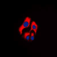LYN Antibody (C-Terminus)