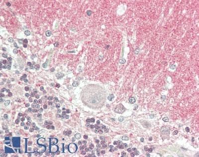 PathPlus™ SNCA / Alpha-Synuclein Antibody (aa61-140)