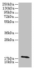 RPP21 Antibody