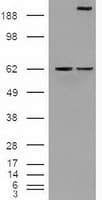 NOTCH1 Antibody (clone OTI3E12)
