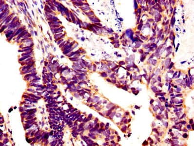 Polyclonal Rabbit anti-Human GLI / GLI1 Antibody (WB)