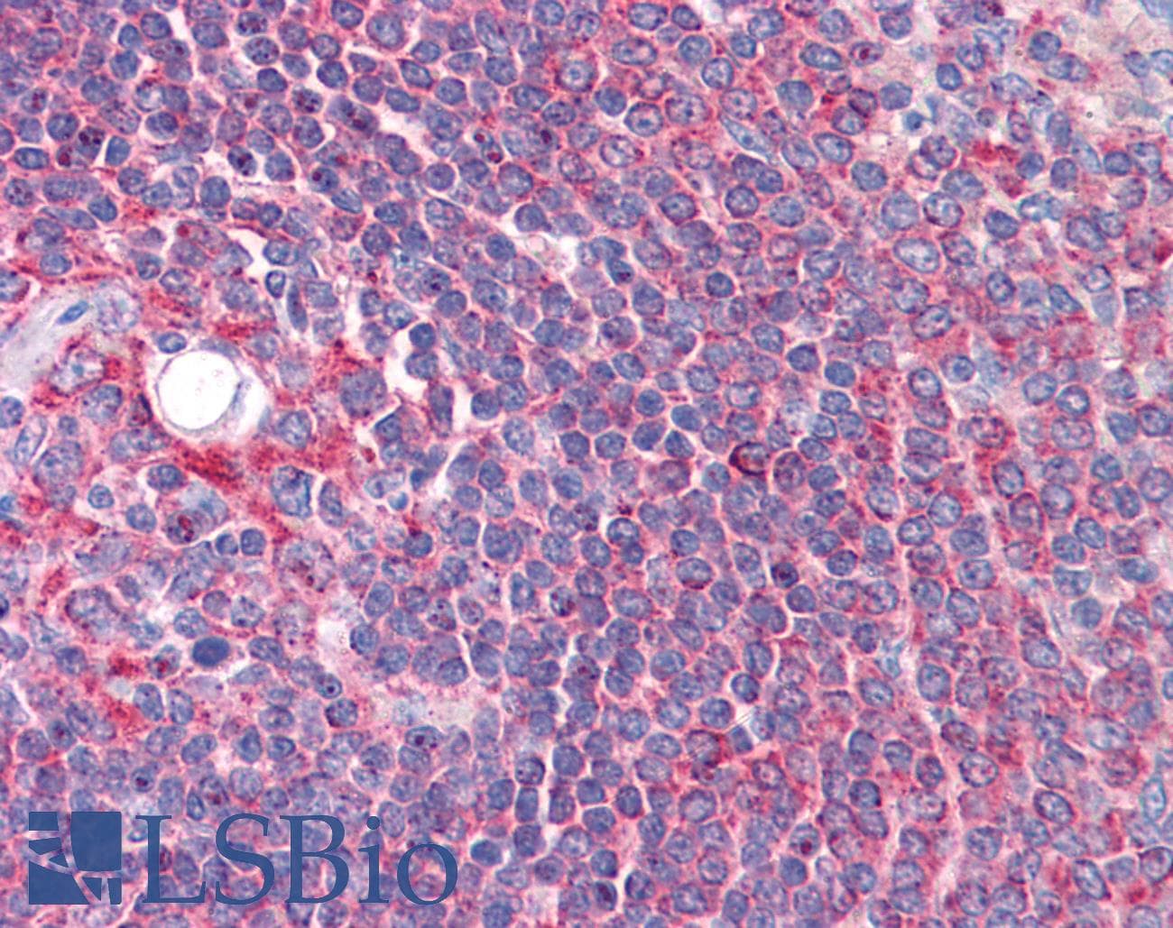 IHC-plus™ CYP26B1 Antibody (aa418-430)