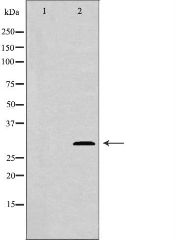 NTF3 / Neurotrophin 3 Antibody