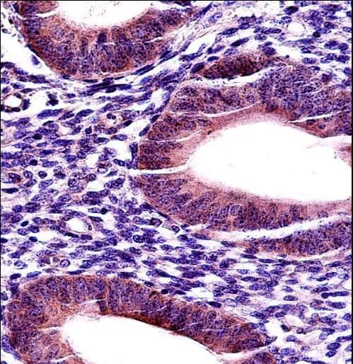 MMP17 Antibody (aa432-460)