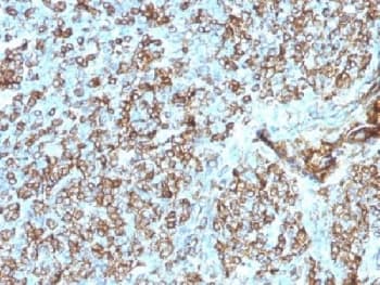 HLA-DP+DQ+DR Antibody (clone CR3/43)
