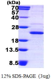 Human DCTPP1 / XTP3TPA Protein (Recombinant His)