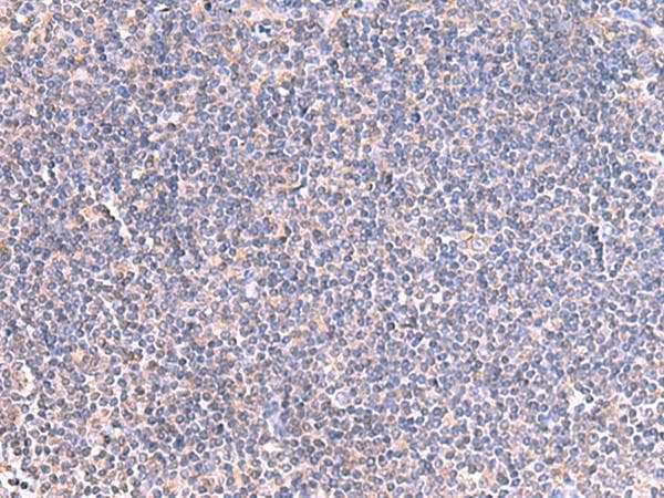 GRIA2 / GLUR2 Antibody
