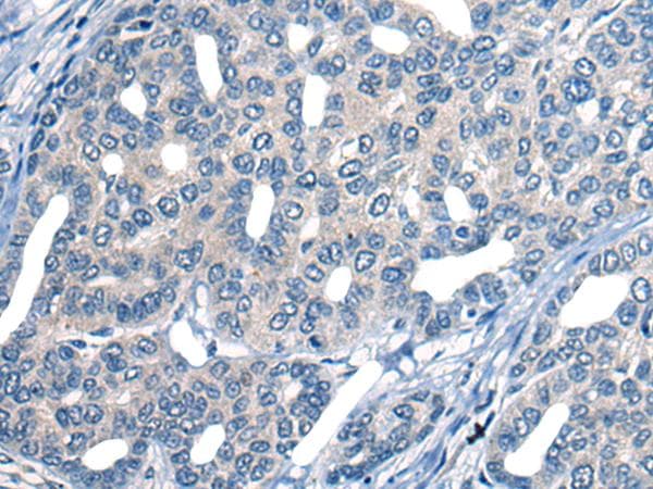 MARK2 Antibody