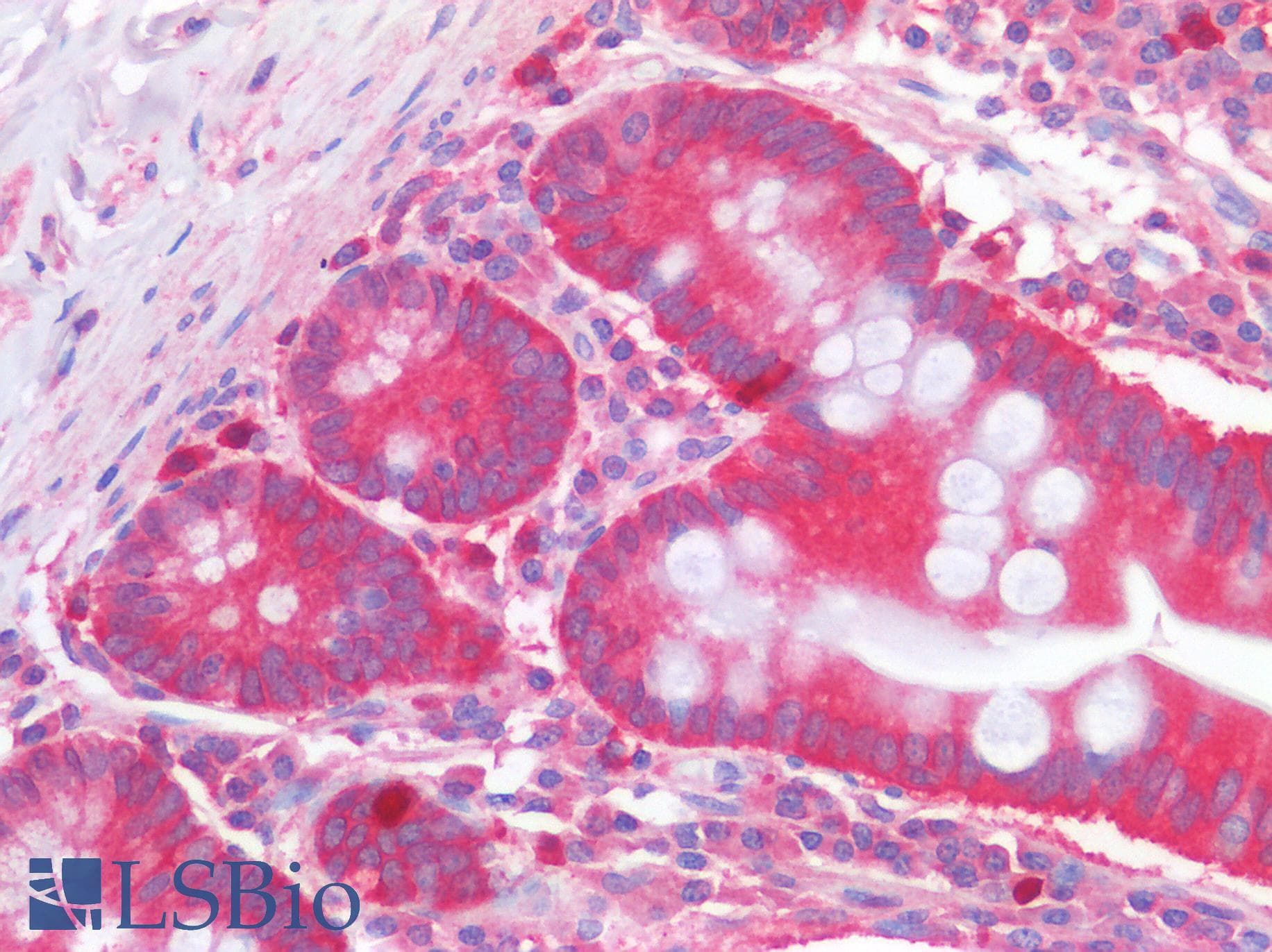IHC-plus™ TNFSF4 / OX40L / CD252 Antibody