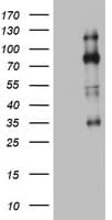EZH2 Antibody (aa182-431, clone OTI2B10)