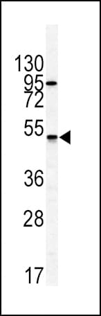GIPR / GIP Receptor Antibody (aa7-38)