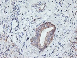 PFDN6 / HKE2 Antibody (clone OTI4E10)