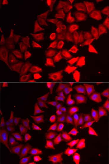 CMPK / CMPK1 Antibody