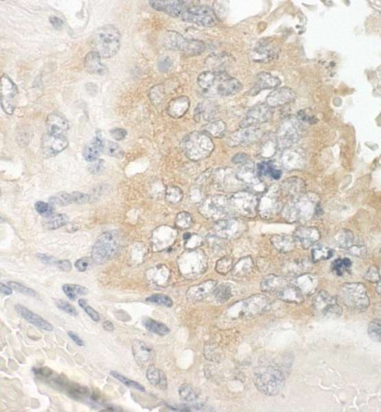 Polyclonal Rabbit anti-Human MAPRE1 / EB1 Antibody (aa245-268, IHC, IF)