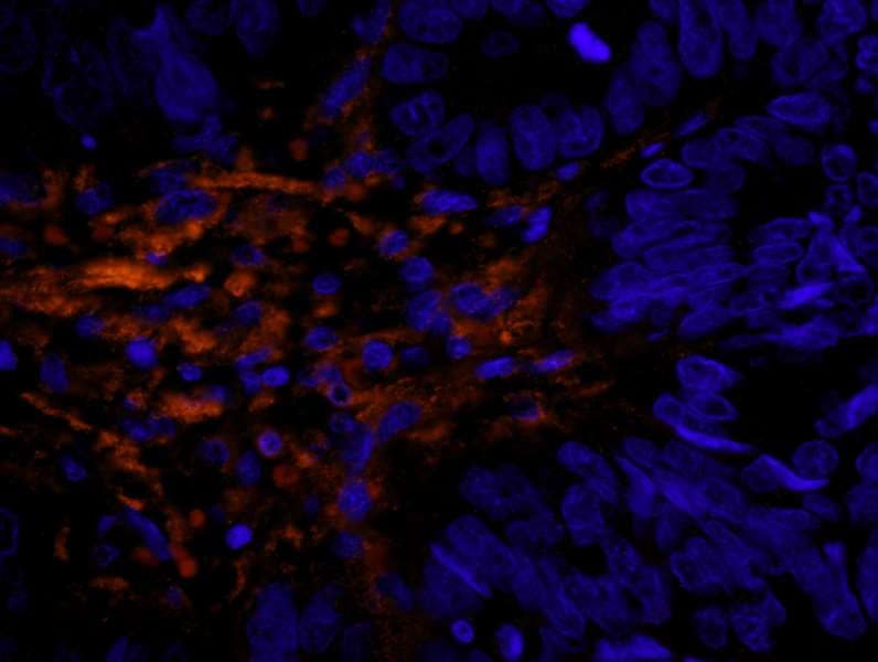 FLNA / Filamin A Antibody (aa1725-1775)
