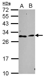 IHC-plus™ TATDN3 Antibody