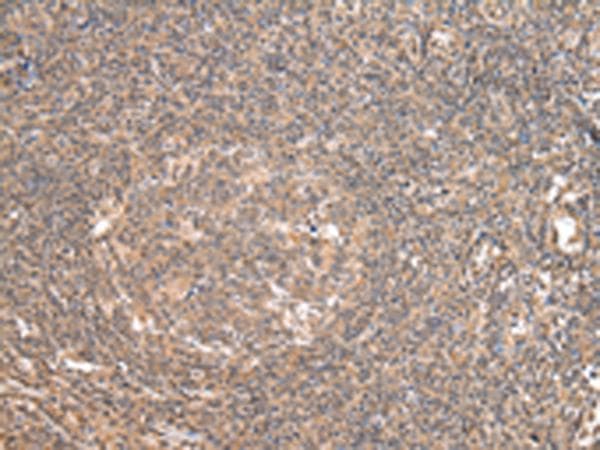 DDX58 / RIG-1 / RIG-I Antibody