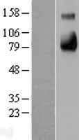 SELE / CD62E / E-selectin Protein (Over-Expression Lysate Myc-DDK (Flag))