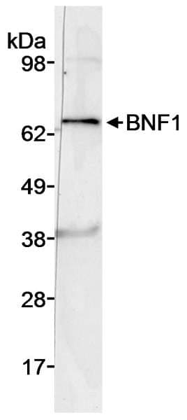 Polyclonal Rabbit anti-Human CHRDL2 Antibody (aa200-250, WB)