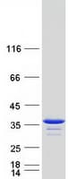 Human LHPP Protein (Recombinant Myc-DDK (Flag))
