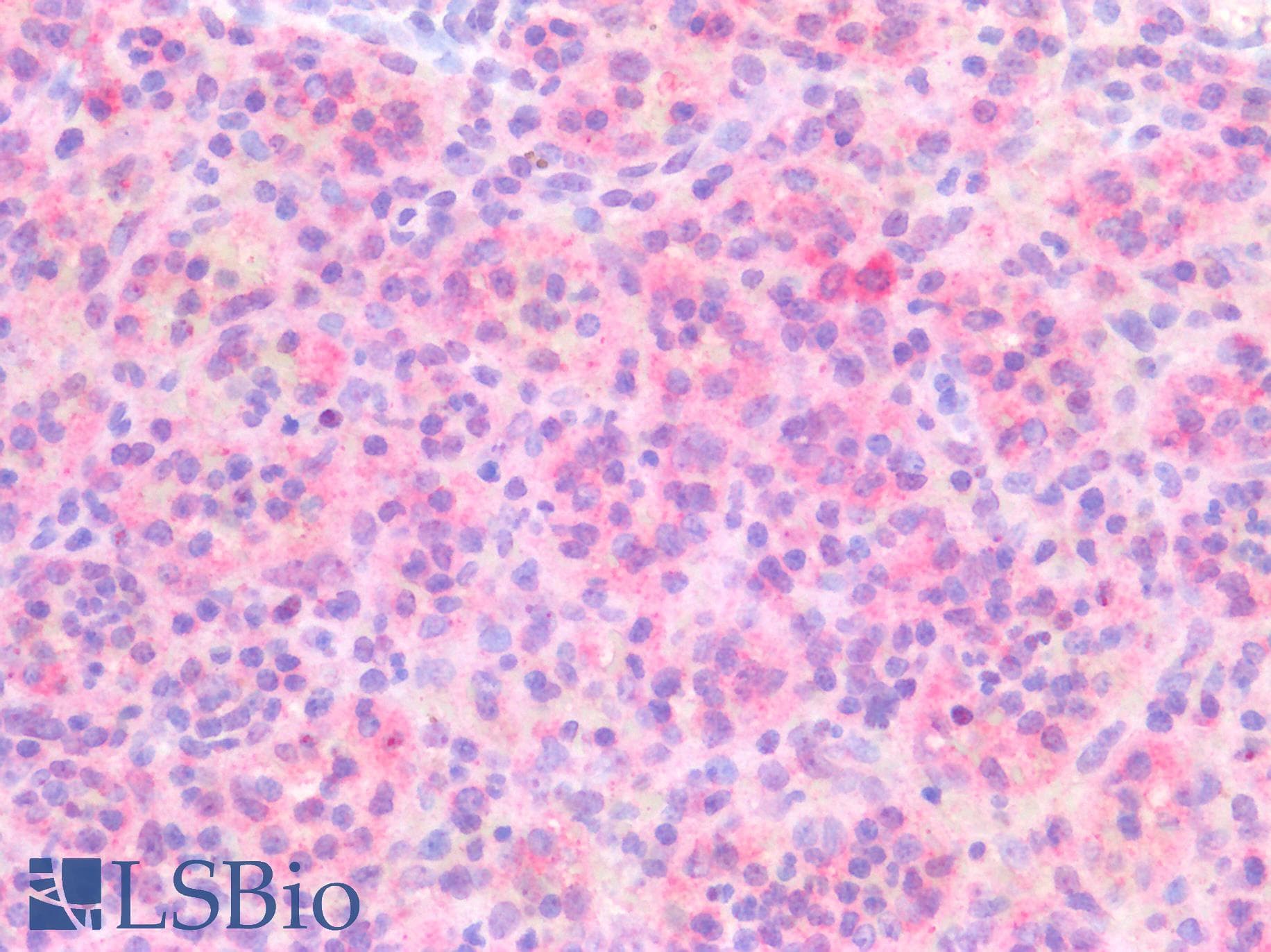 Monoclonal Mouse anti-Human RHOC Antibody (IHC, WB)