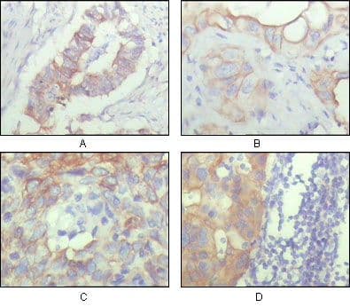 ALCAM / CD166 Antibody (Amino Acid: 405-524, clone 10F1G12)